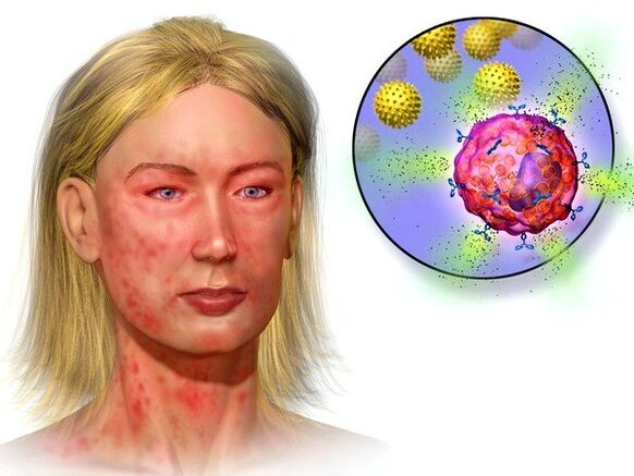 Echinokokken und Symptome ihrer Anwesenheit im Körper