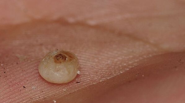 Sarkopsillose mit subkutanen Parasiten