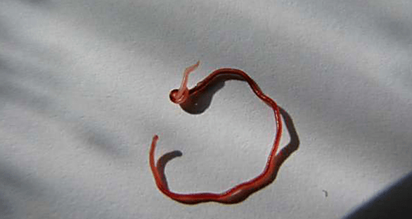 subkutaner parasitärer Wurm des Menschen