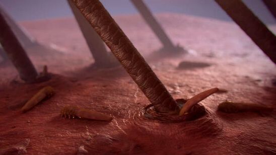 Subkutane Parasiten des Menschen unter dem Mikroskop